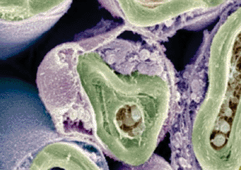 Image:  Schwann cells (colored purple) forming myelin sheathes (green) around axons (brown) (photo courtesy of David Furness, Wellcome Images).